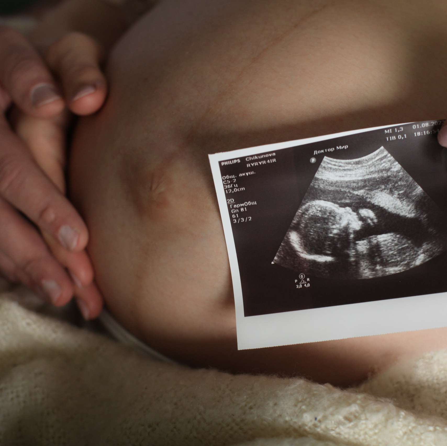 Фотографии детей до года