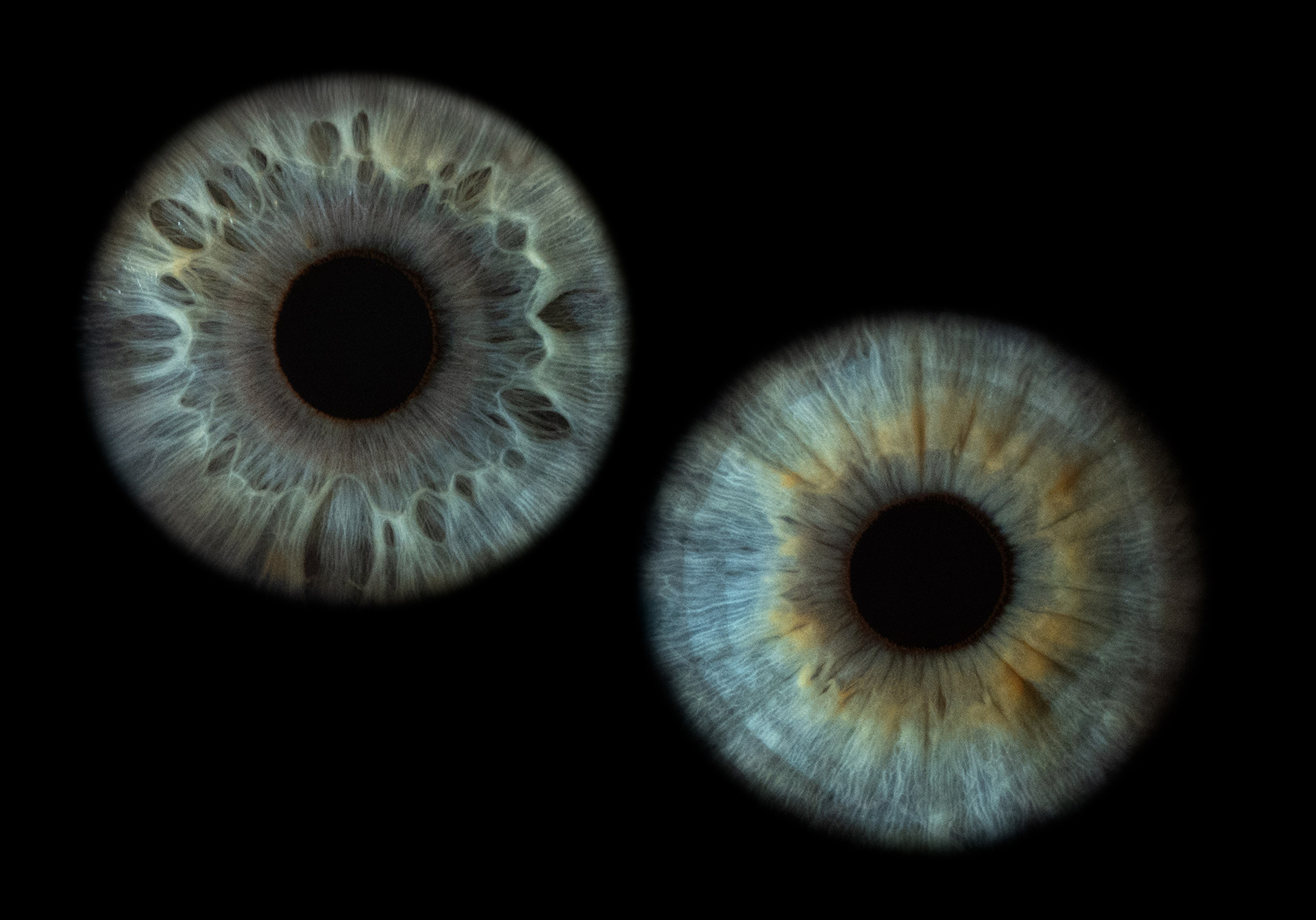 Дуэт радужки глаз, Севастополь, Ojo Art студия радужки глаз