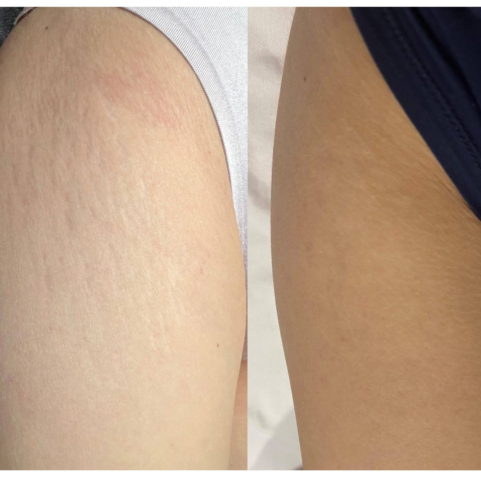 Элла. Студия перманентного макияжа, косметологии и массажа SYMMETRY в Москве, м. Киевская