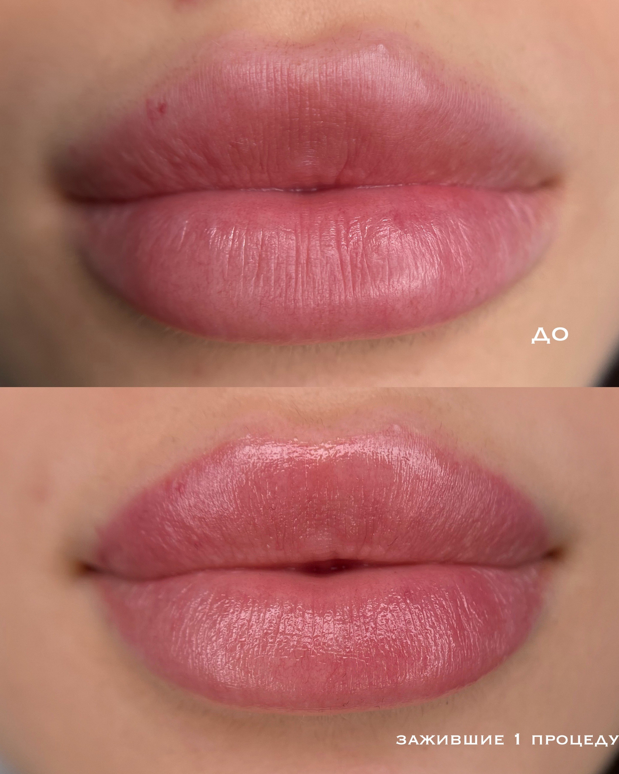 увеличение губ и перманентный макияж 