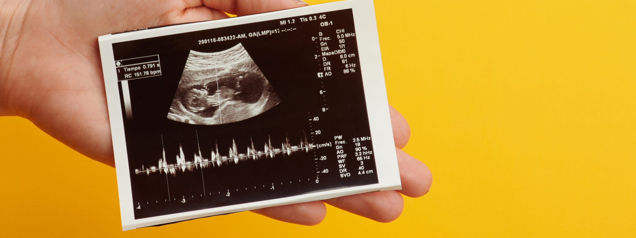 Ведение беременности и роды