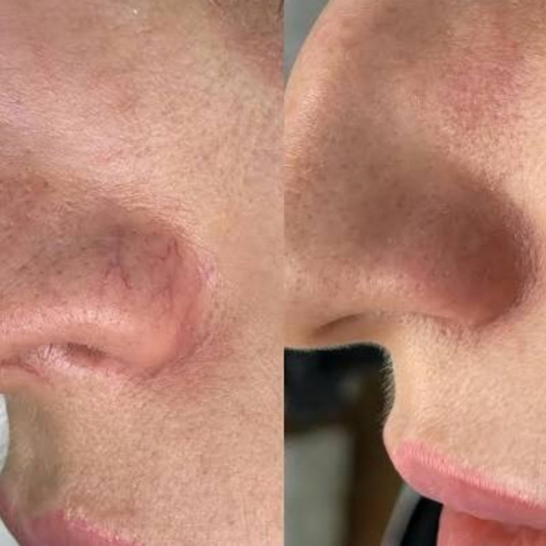 Элла. Студия перманентного макияжа, косметологии и массажа SYMMETRY в Москве, м. Киевская