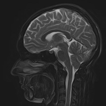 Услуги. РЕНТГЕН КТ МРТ в Санкт-Петербурге Александра Лоншакова