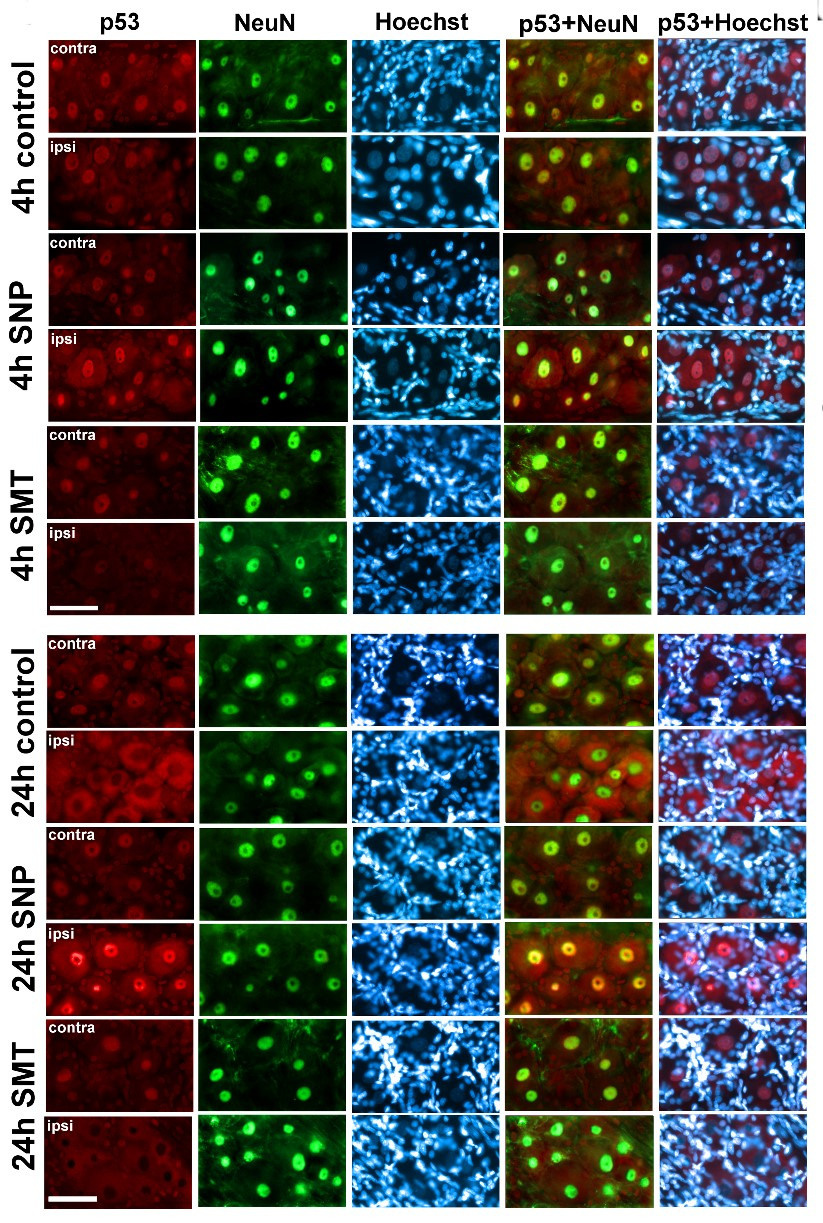 Нейропротекция. Главная