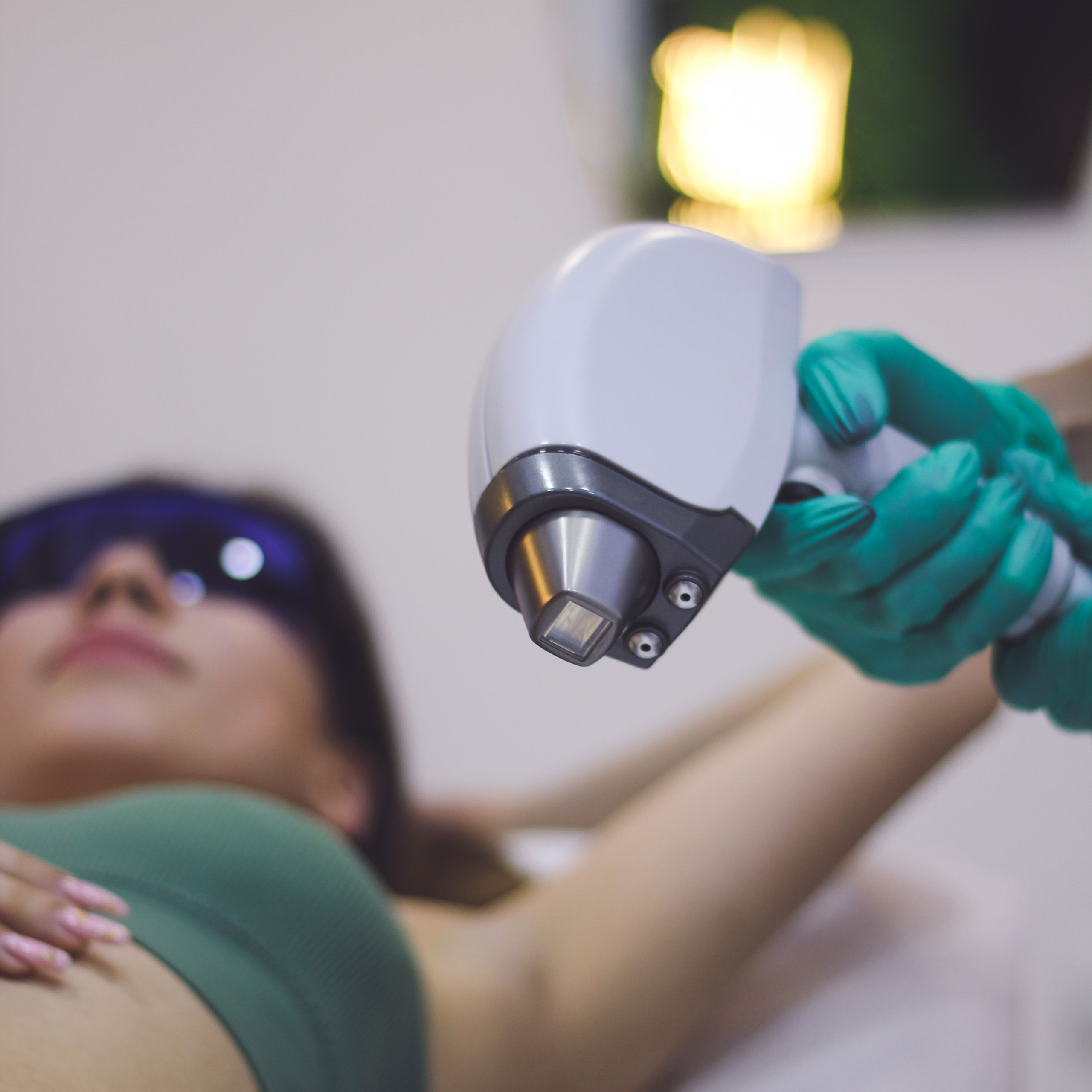 лазерная эпиляция 