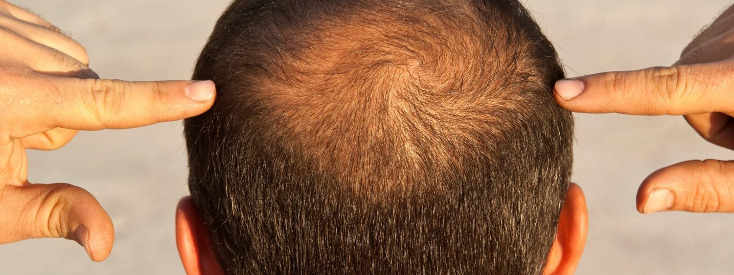 Как принимать комплексные пищевые добавки компании Сово-Сова?. «Сово-Сова» продукция для омоложения, здоровья и долголетия