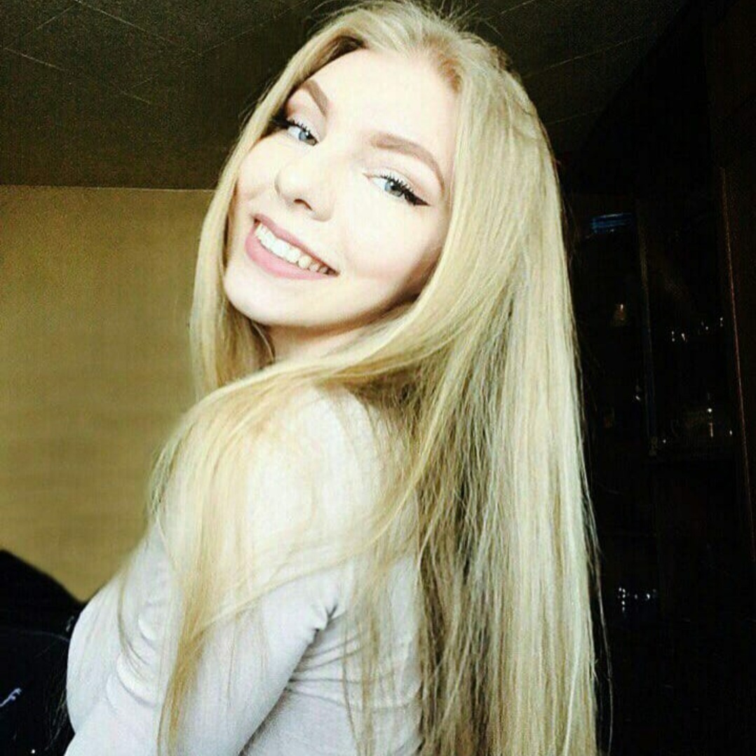 Результаты работ до/после и замечательные улыбки. Стоматология «Ортодонт-Эстетик». Установка брекетов в Оренбурге, взрос