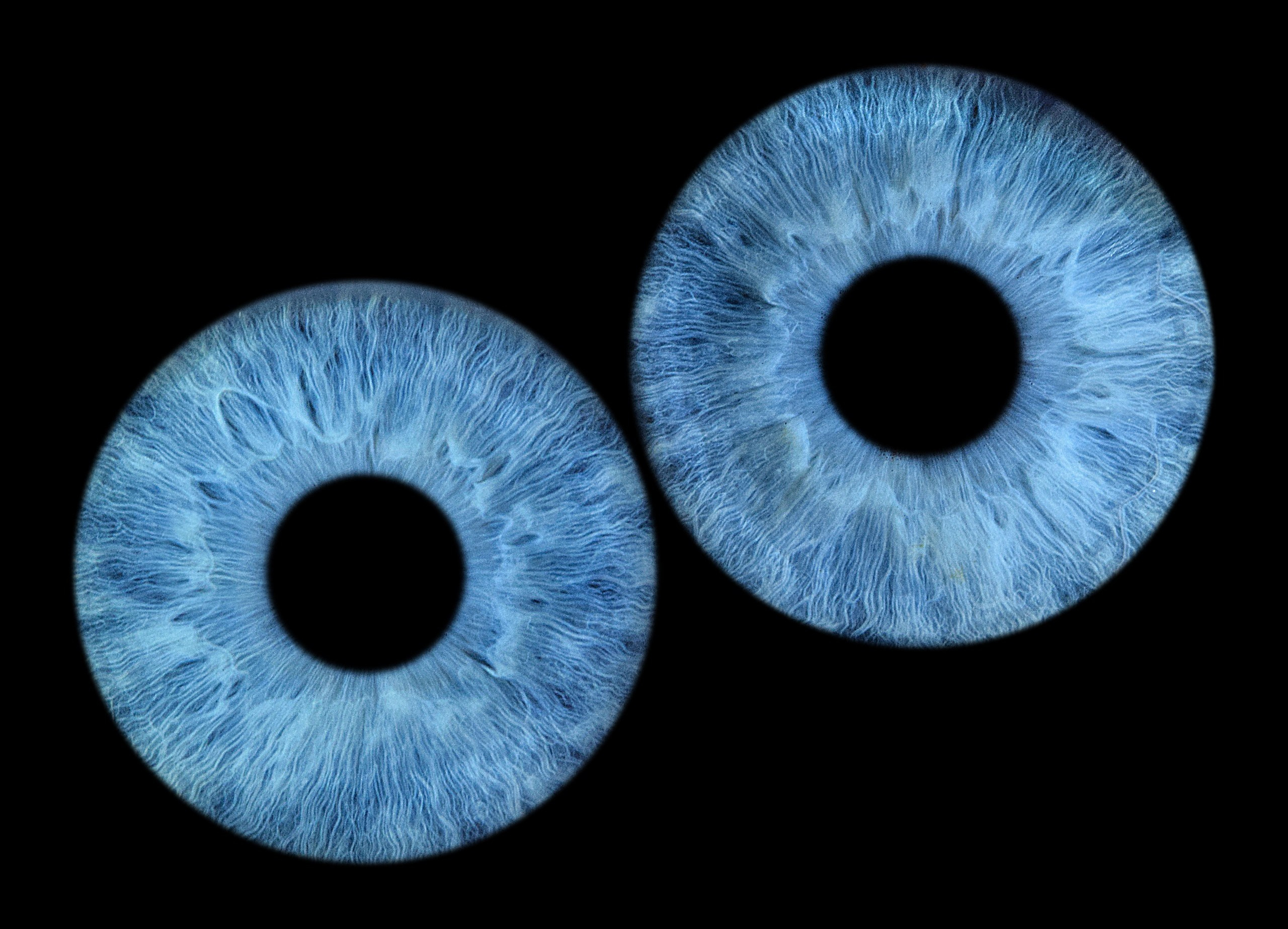 EYEtob | Фотография радужной оболочки | Тобольск