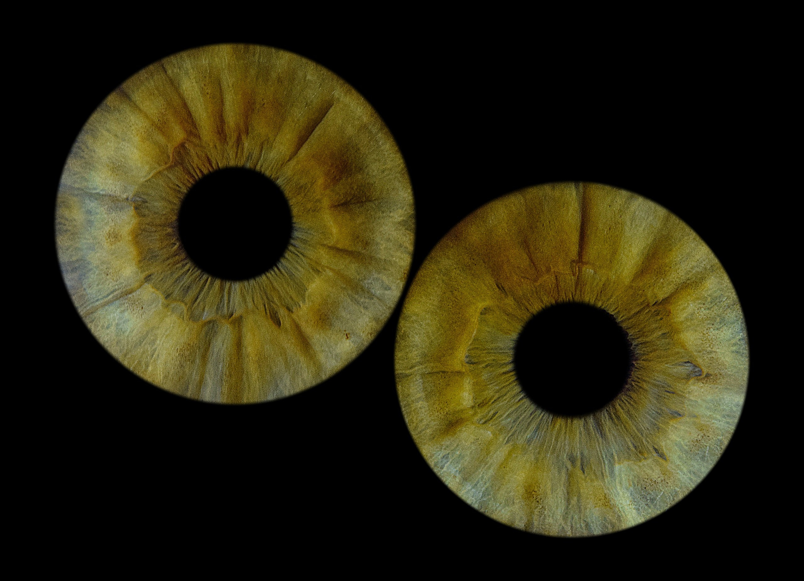 Контакты. EYEtob | Фотография радужной оболочки | Тобольск