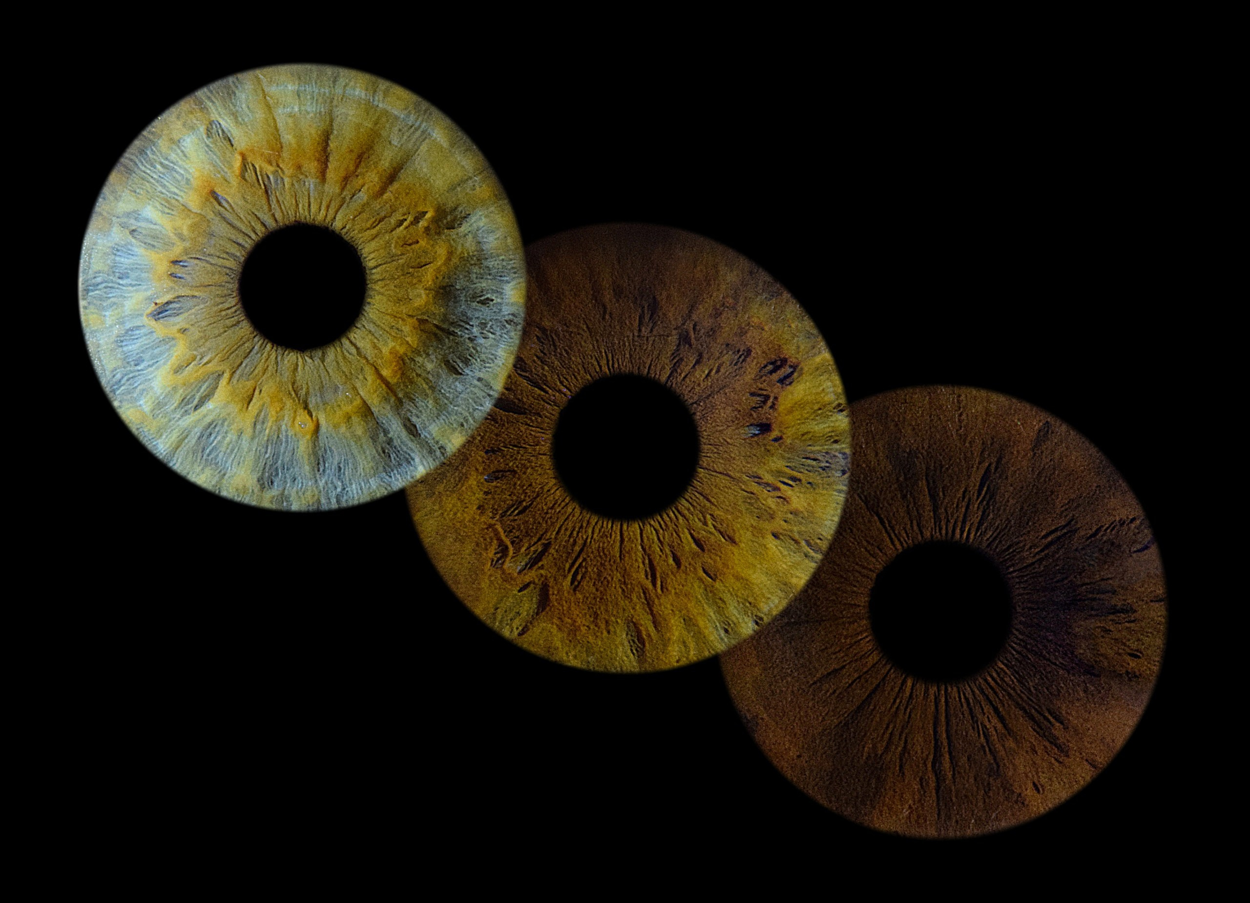 Контакты. EYEtob | Фотография радужной оболочки | Тобольск