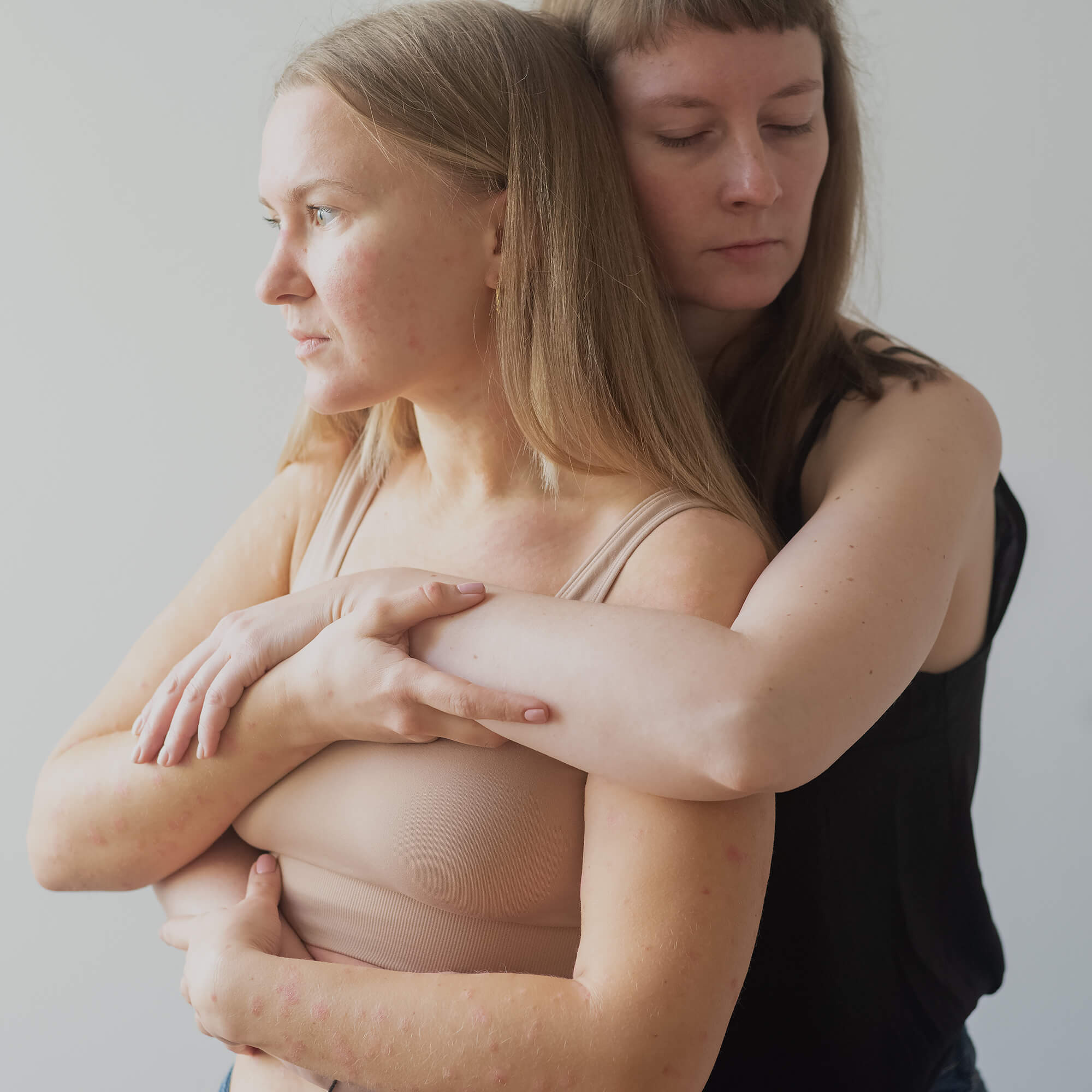 художественный портрет девушки в псориаз