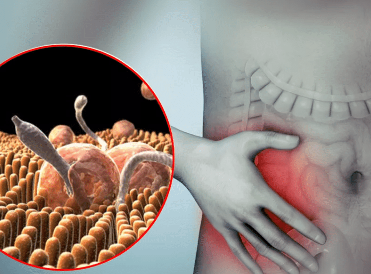 Паразиты в организме человека. Вред и последствия. Сово-Сово — Омоложение и оздоровление!