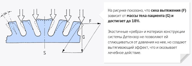 ДЕТЕНЗОР для лечения спины. Медицина с душой