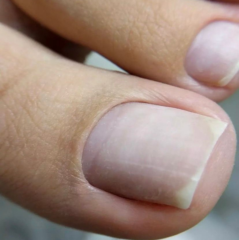 Педикюр Севастополь. Обработка пальцев ног 