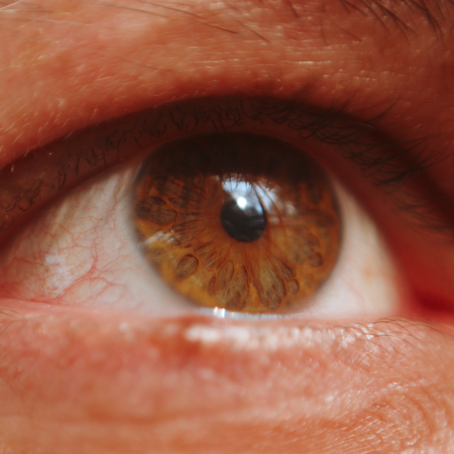 Глазомания