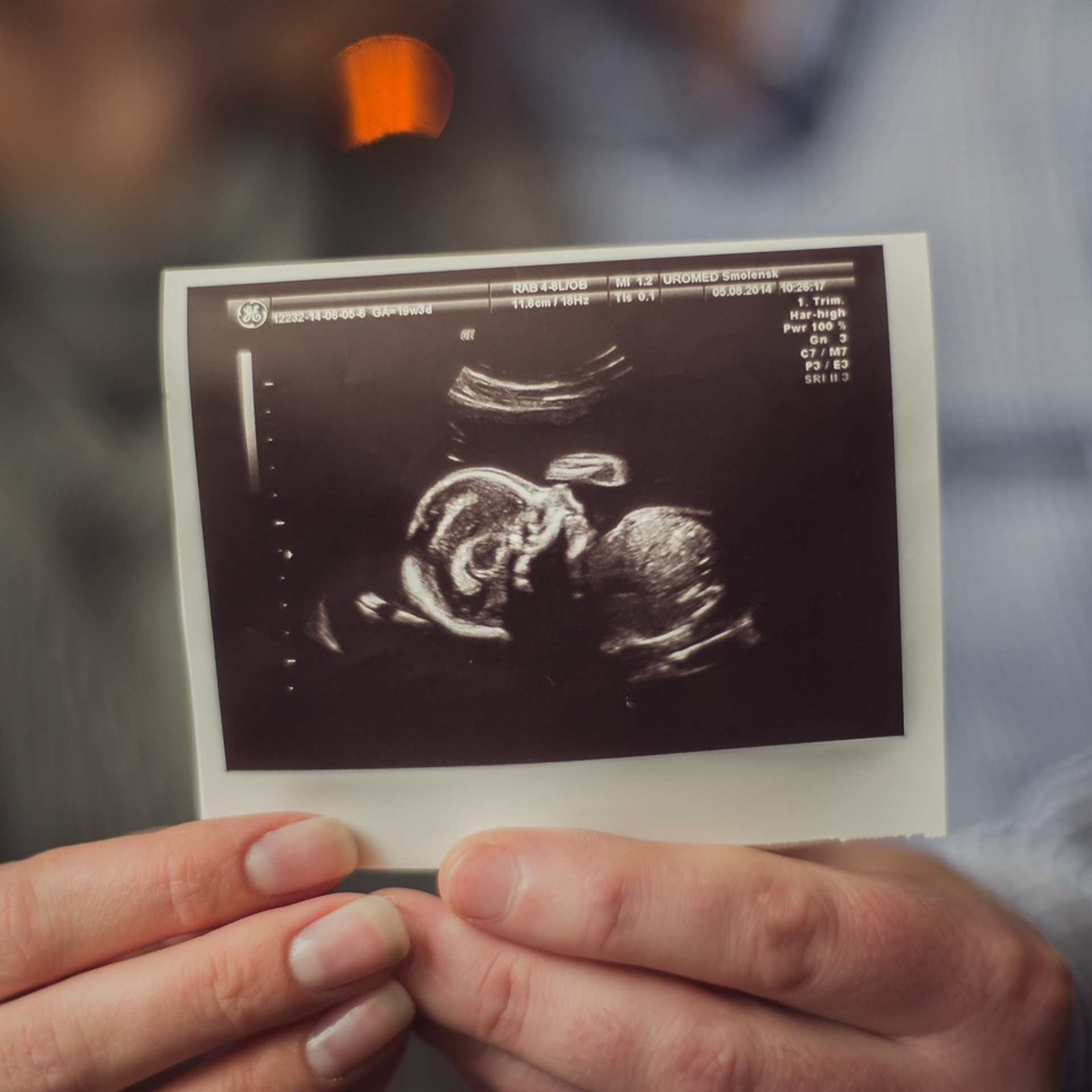 В ожидании. Фото и видео на роды Москва Ирина Жарковская | BIRTH.DAY PHOTO