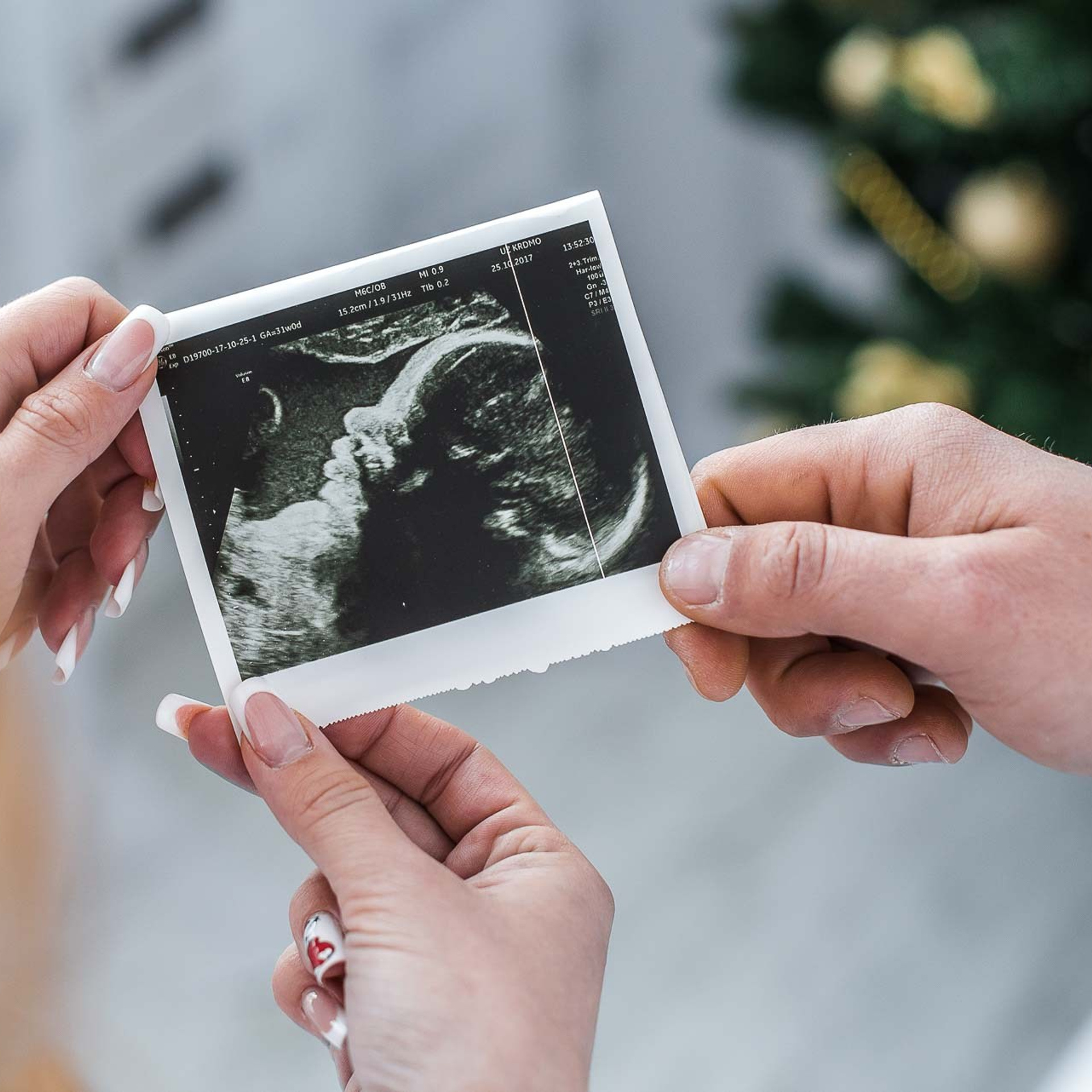 Беременность. Фотограф в Борисове видеосъемка Игорь Шушкевич