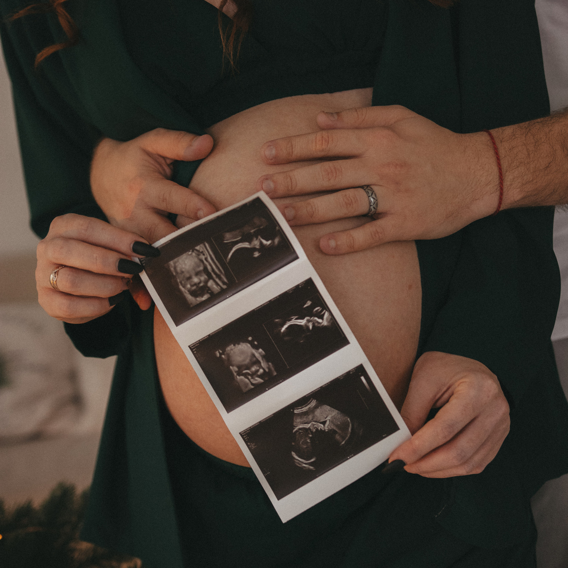 Отзывы. Условия и стоимость