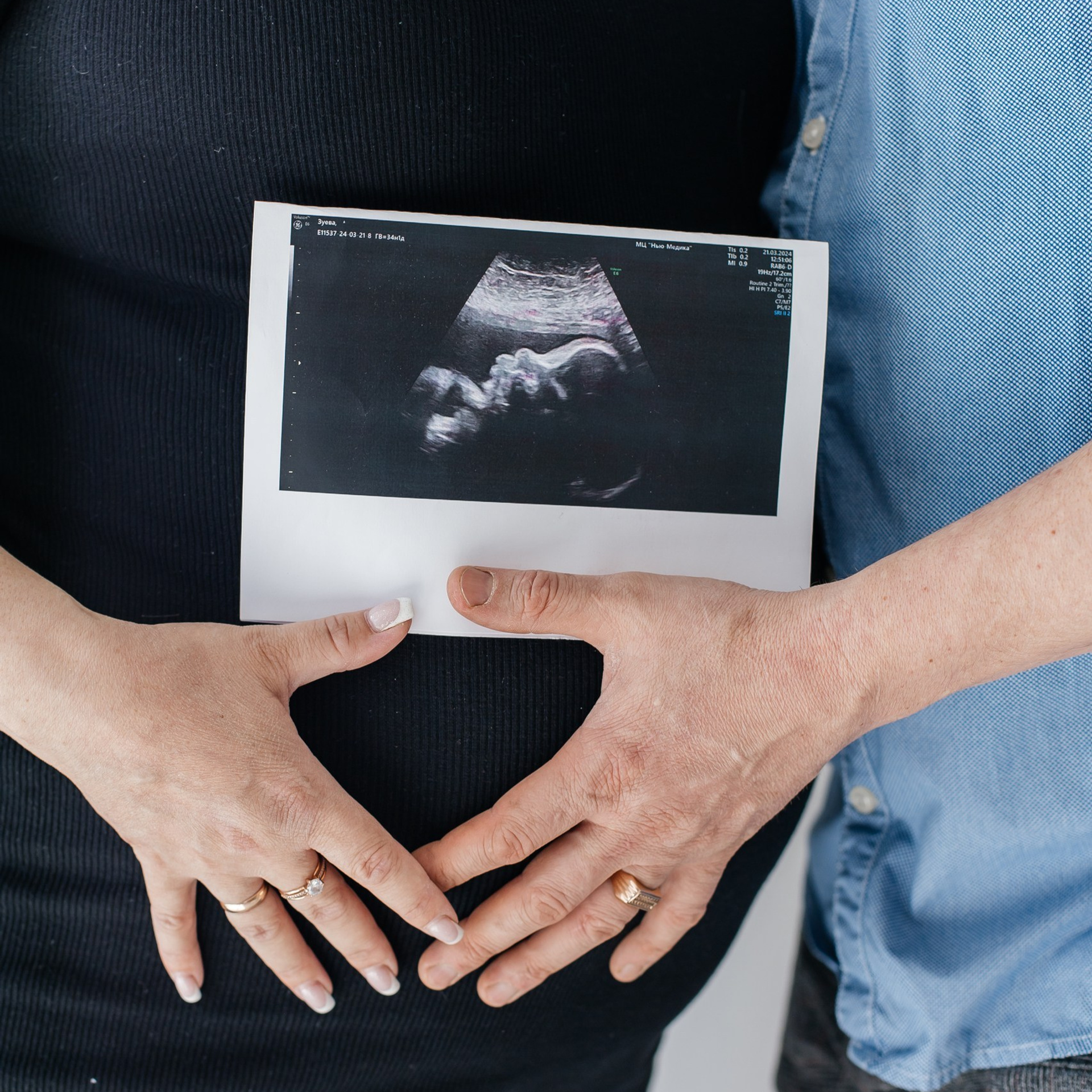 Отзывы. Фотограф Валерия Лобковская