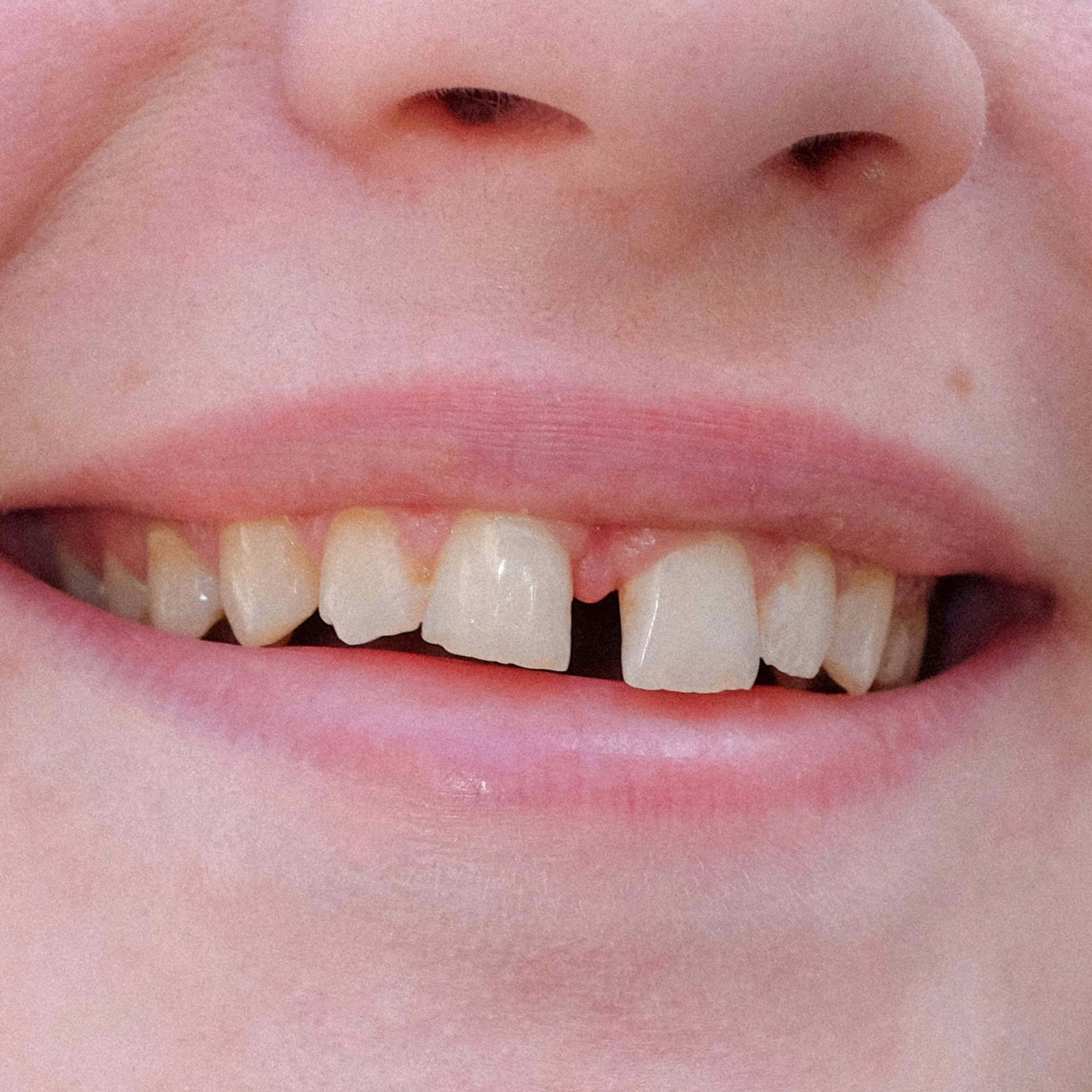 Серия «Без названия». Vadim Sidorov