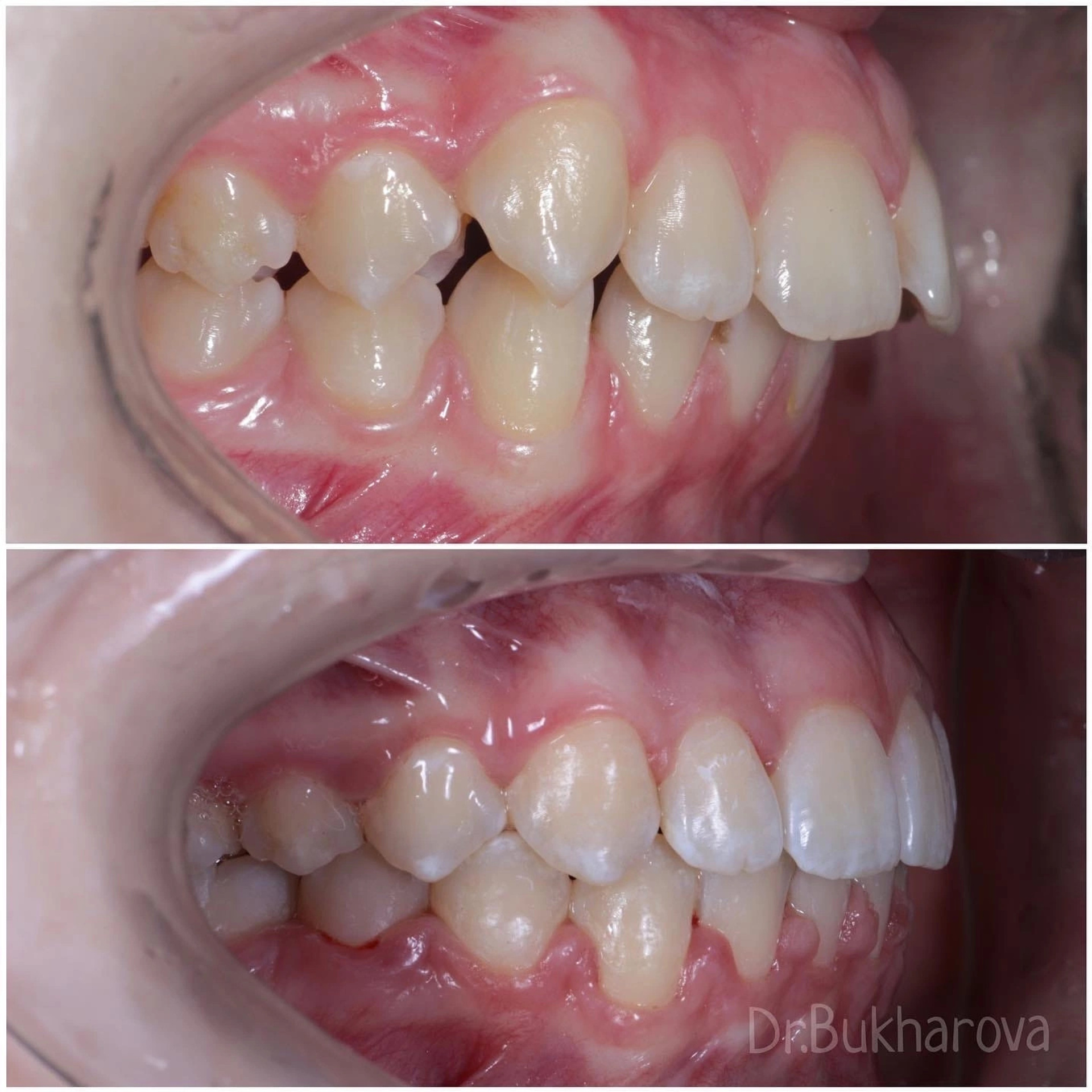 Ортодонтия. Стоматология в Твери - Линия Улыбки