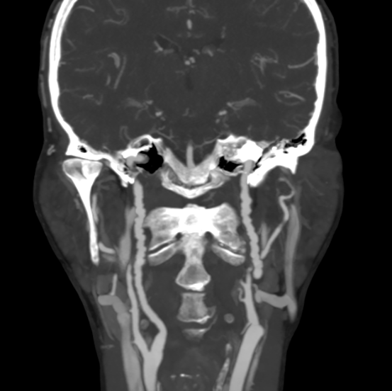 Бусы могут быть не только на шее, но и внутри нее. РЕНТГЕН КТ МРТ в Санкт-Петербурге Александра Лоншакова