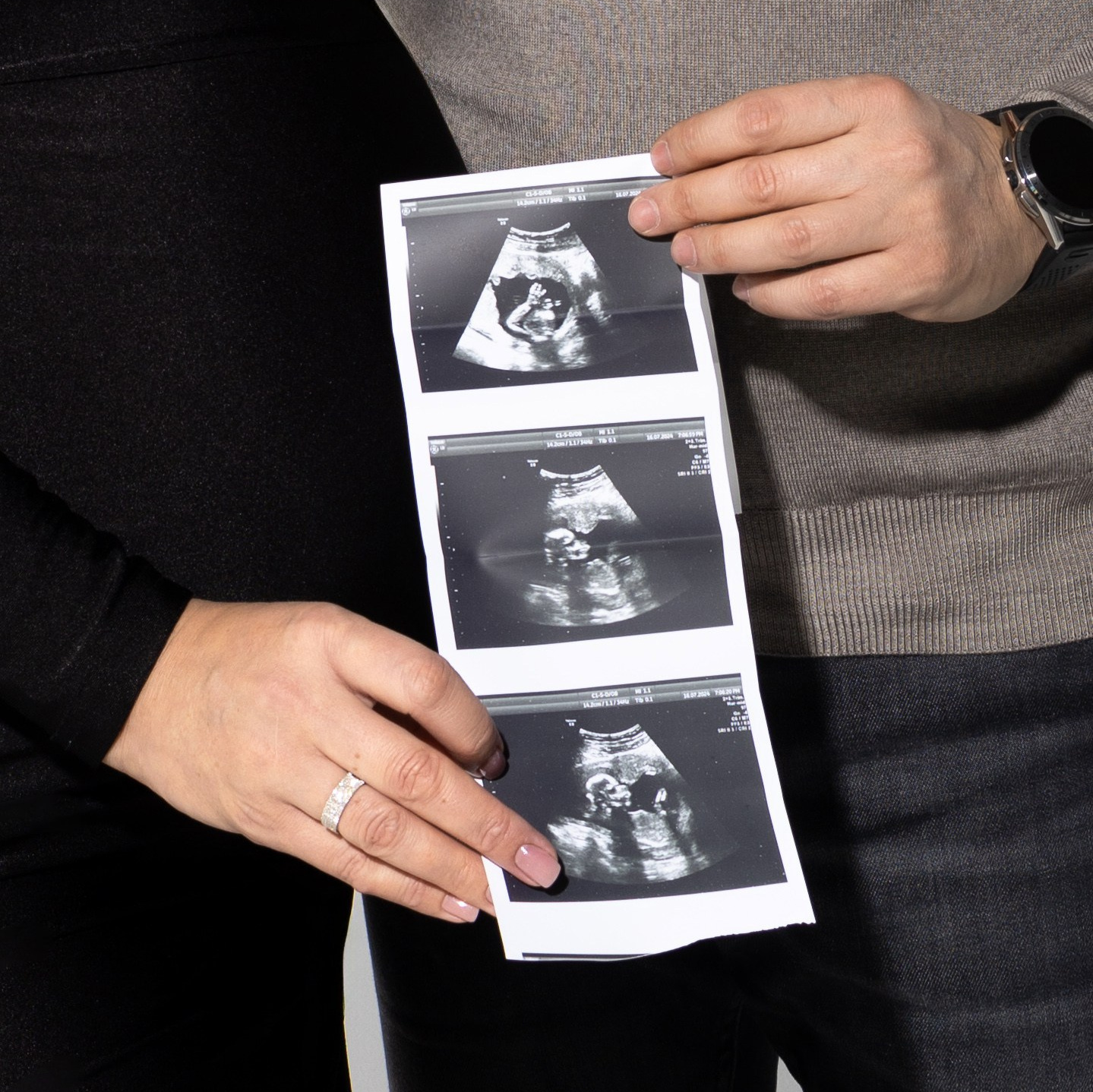 Руки будущих родителей с УЗИ-снимком, ожидание малыша, фотосессия беременности в Красноярске
