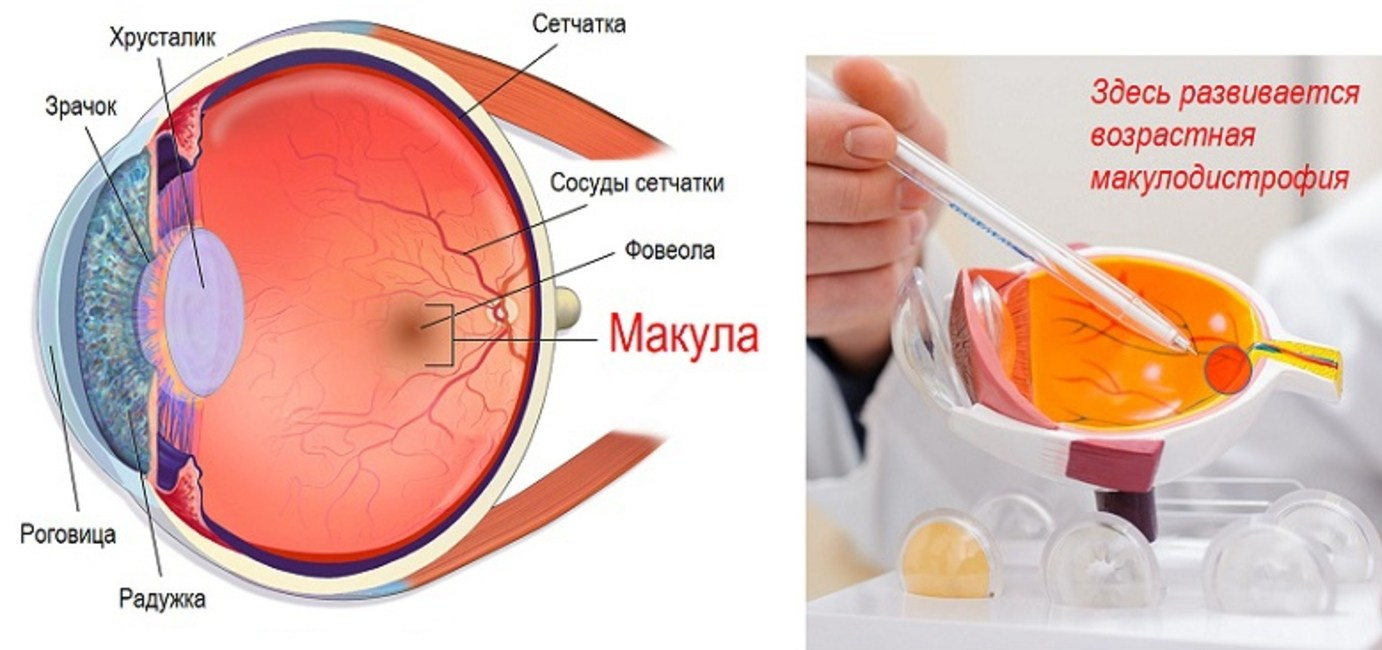 ГЛАУКОМА, ХСОН, ВОЗРАСТНАЯ МАКУЛОДИСТРОФИЯ. «Сово-Сова» продукция для омоложения, здоровья и долголетия