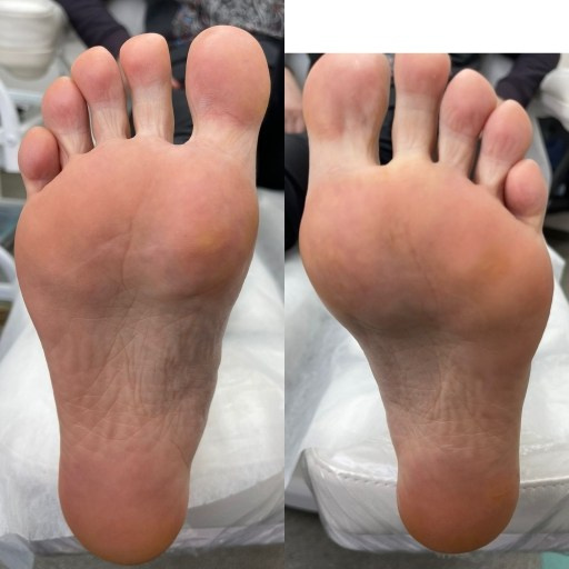 Педикюр + гельлак. Работа Джулии Щёголевой. Подолог г. Хабаровск — центр здоровой стопы «FOOTTIME»