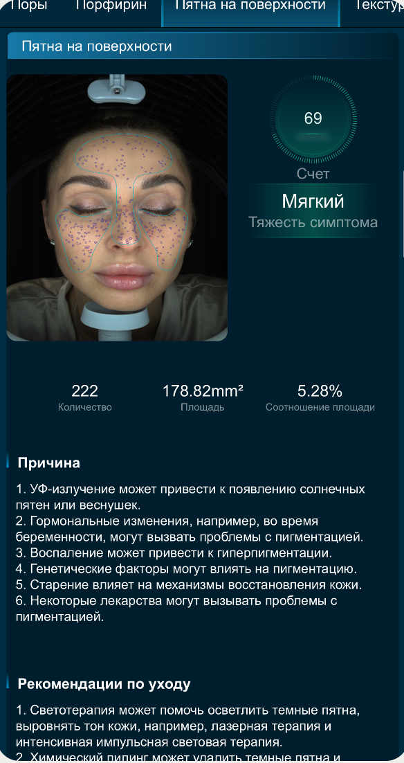 Аппаратная диагностика кожи. Перманентный макияж в Москве | Студия SYMMETRY у м. Киевская | Скидка 10%
