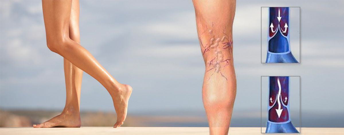 Как принимать комплексные пищевые добавки компании Сово-Сова?. «Сово-Сова» продукция для омоложения, здоровья и долголетия