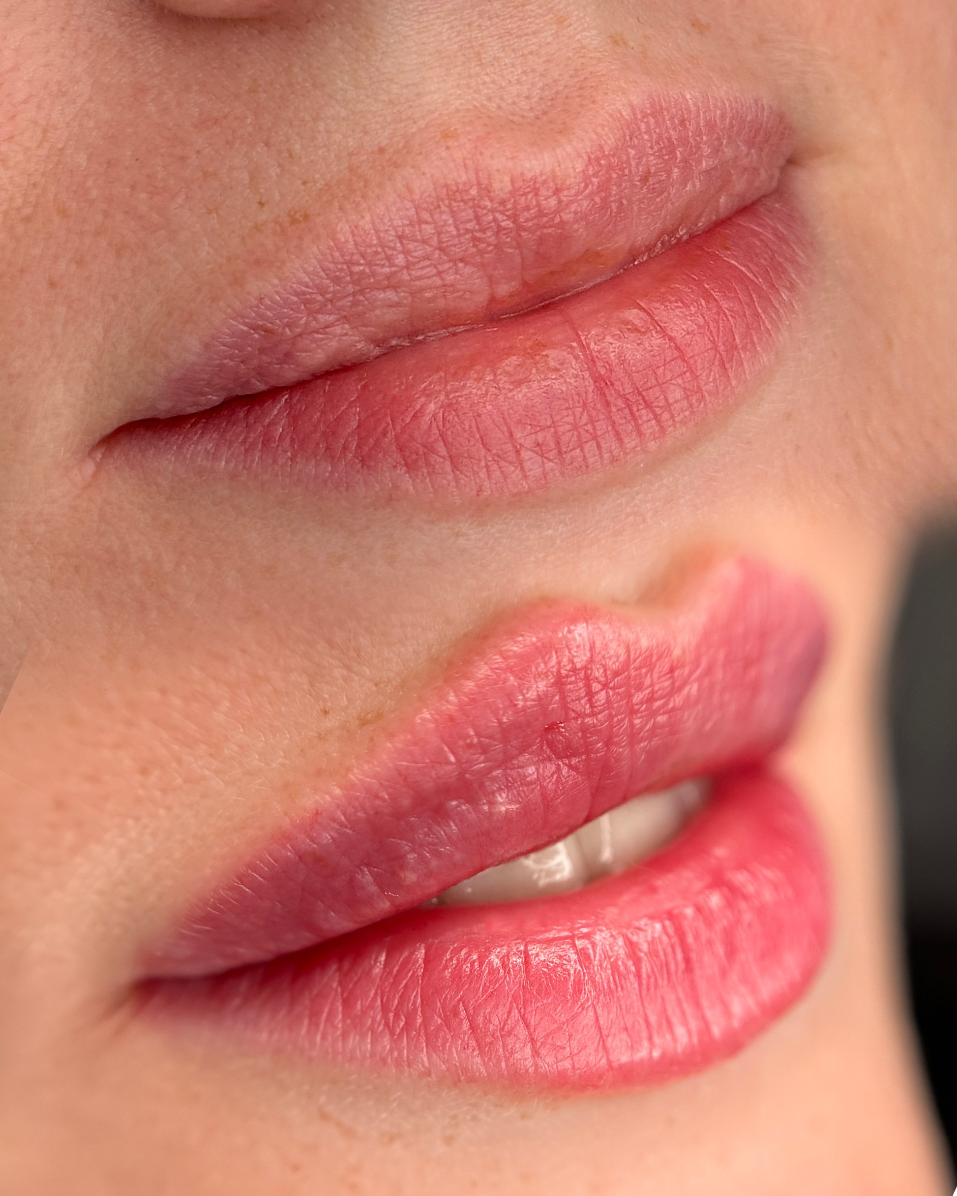 Инъекционная косметология. Студия перманентного макияжа, косметологии и массажа SYMMETRY в Москве, м. Киевская