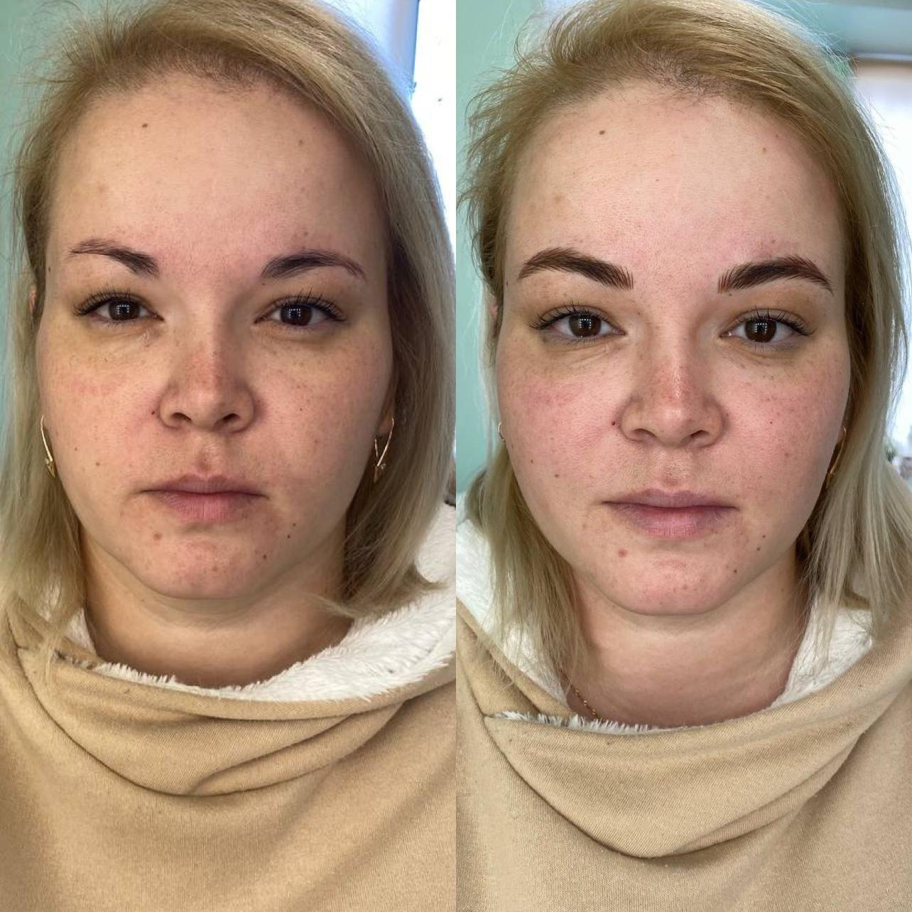 Онлайн обучение волосковой технике гиперреализм. Студия перманентного макияжа, косметологии и массажа SYMMETRY в Москве, м. Киевская