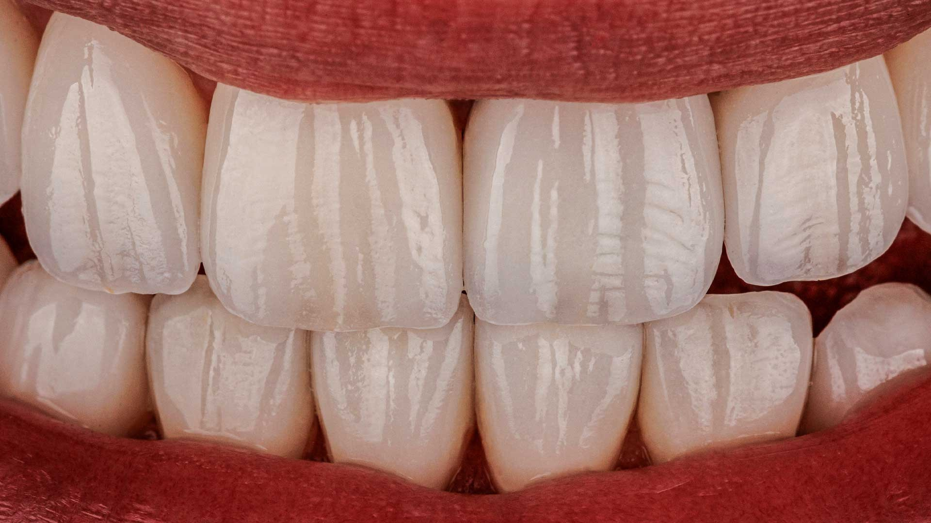 Онлайн-курс Dental Photo PRO: теория, практика, применение