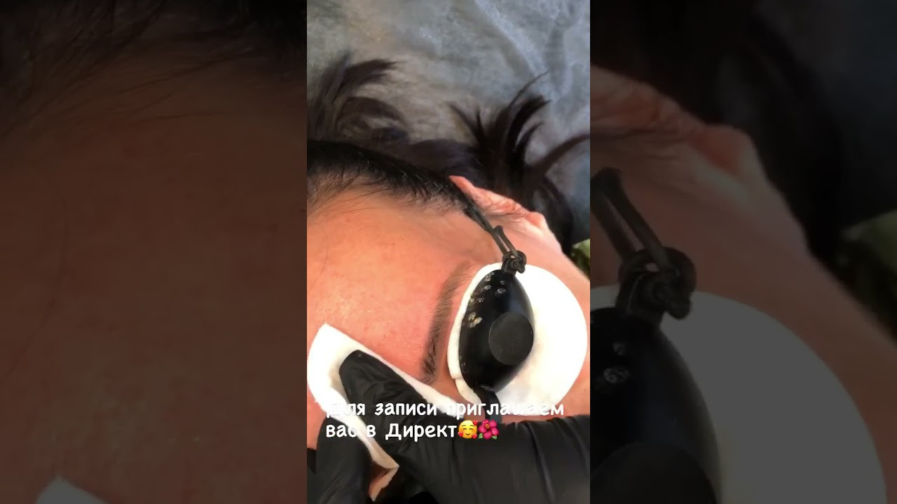 Удаление ПМ. Студия перманентного макияжа, косметологии и массажа SYMMETRY в Москве, м. Киевская