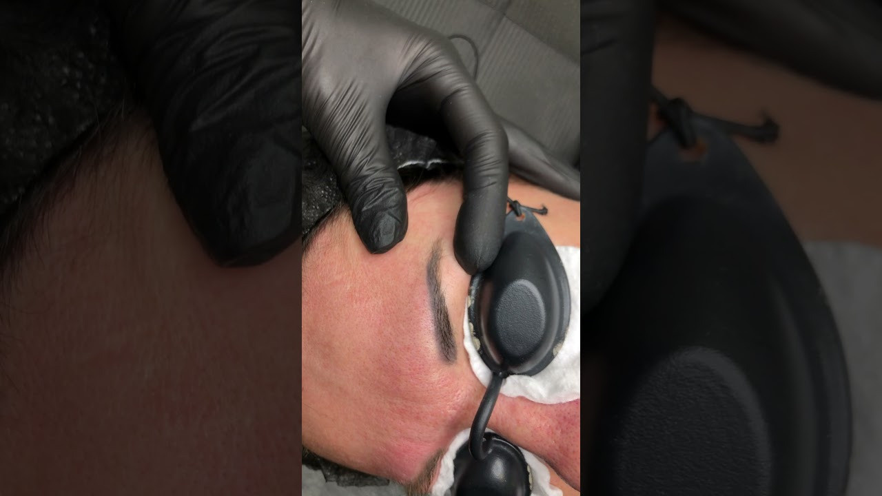 Удаление ПМ. Студия перманентного макияжа, косметологии и массажа SYMMETRY в Москве, м. Киевская