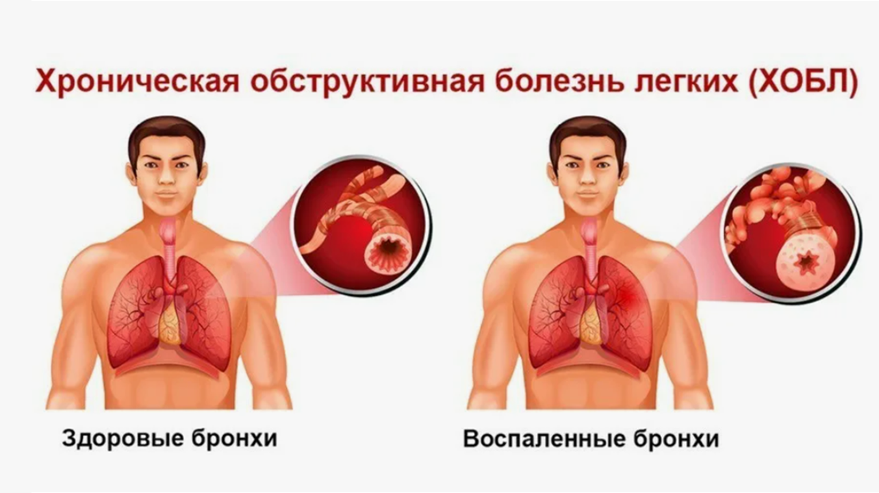 Готовые курсы приема продукции компании Сово-Сова. Сово-Сово — Омоложение и оздоровление!