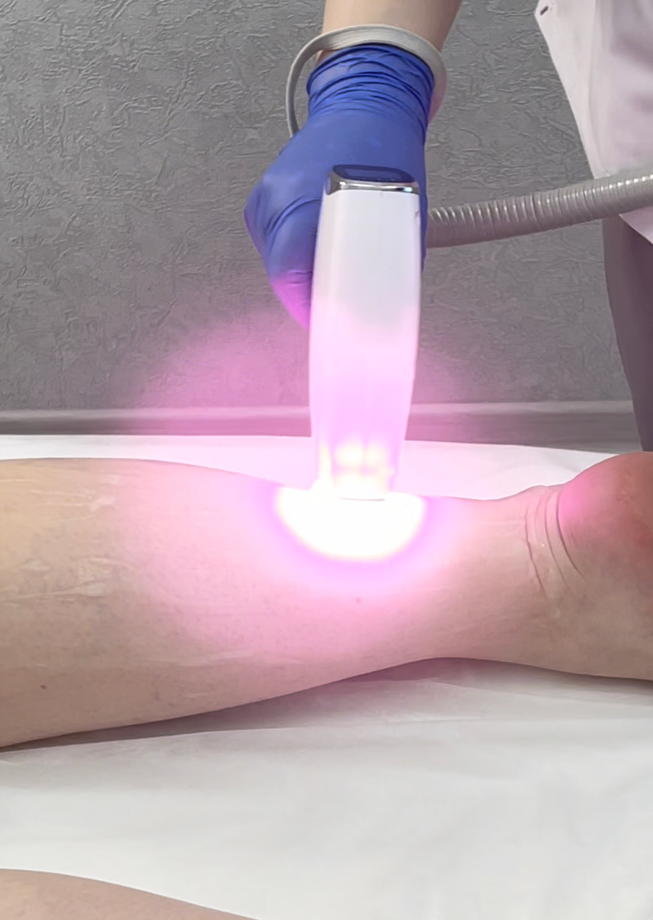 Лазерная эпиляция в г. Кемерово, г. Новокузнецке и г. Киселевске