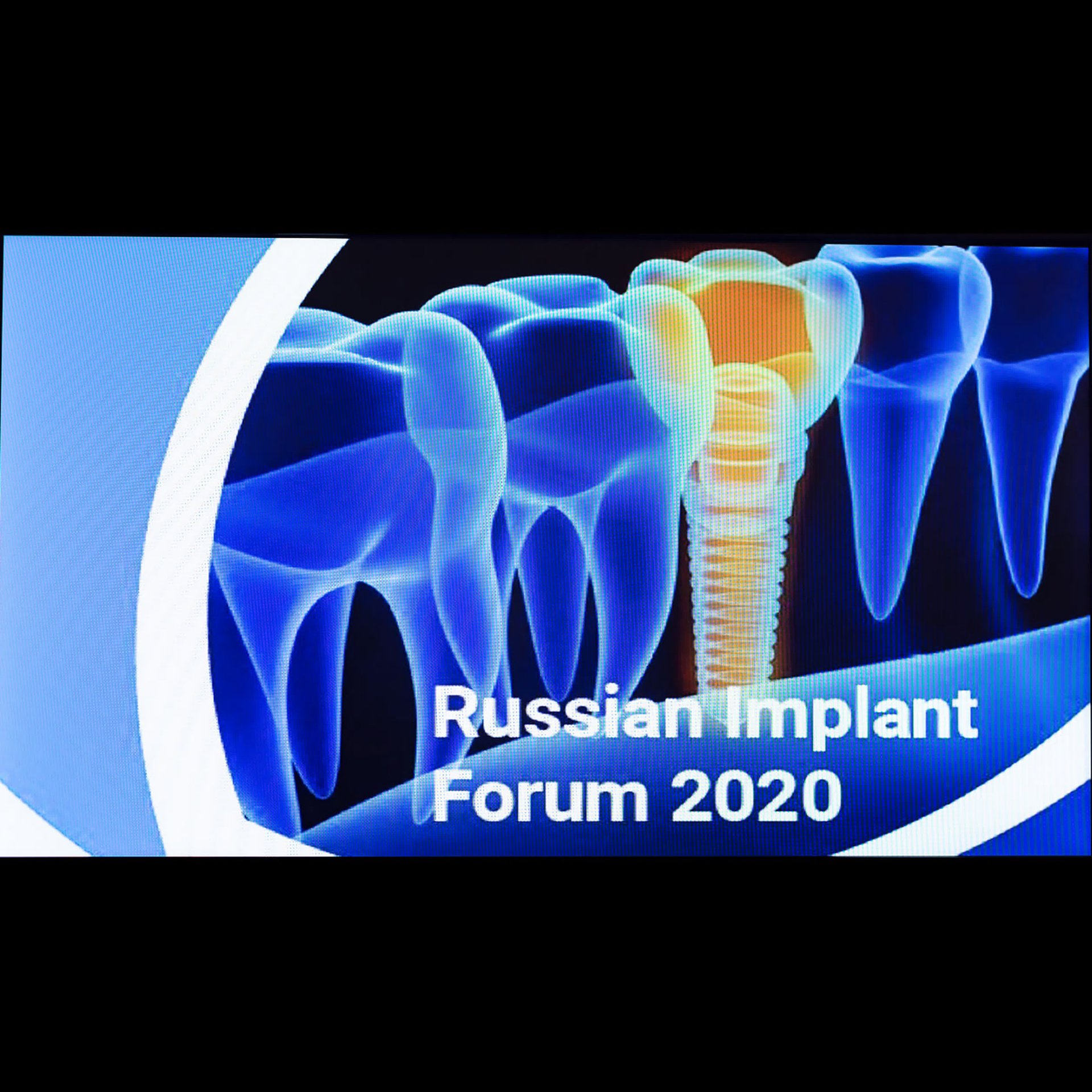 Новые методики в имплантологии на Форуме Форум Russian implant. Свадебный и репортажный фотограф в Москве и Московской области