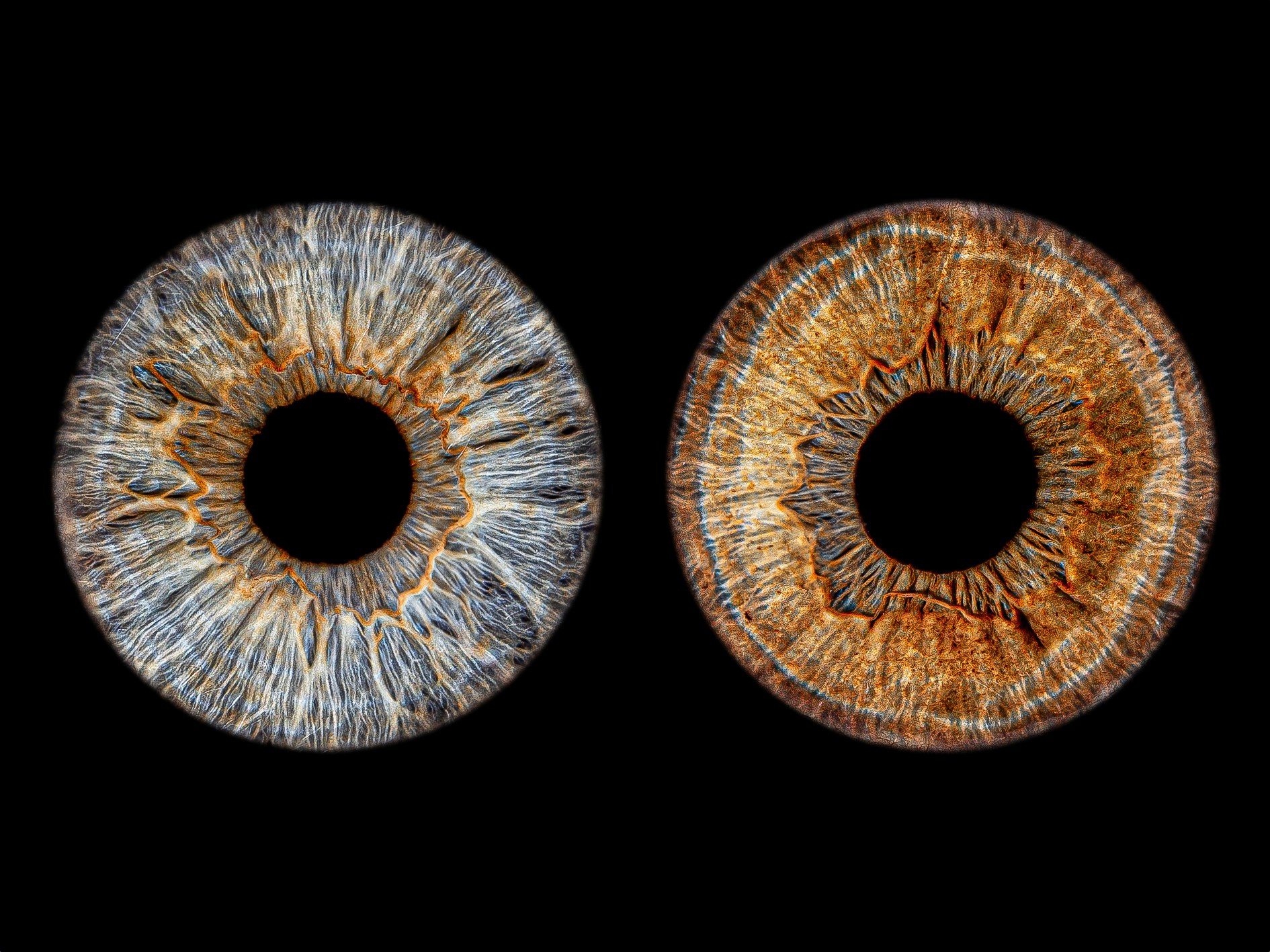 Макро Фото радужки глаза в Зеленоградске