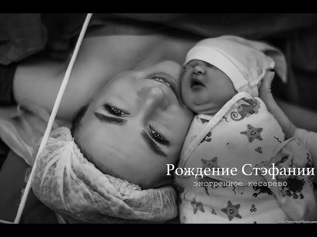 Экстренное Кесарево Сечение. Семейный и детский фотограф в Петрозаводске